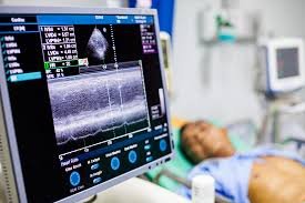 Electrophysiology Services at Yashroop Hospital Gurgaon