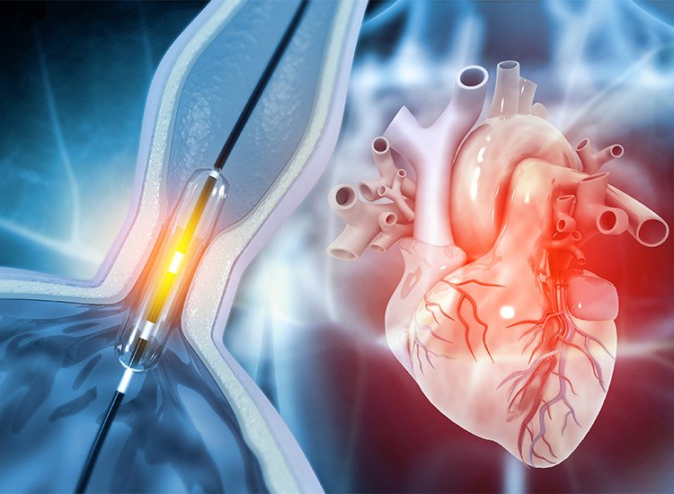 Interventional Cardiology Lab at Yashroop Hospital Gurgaon