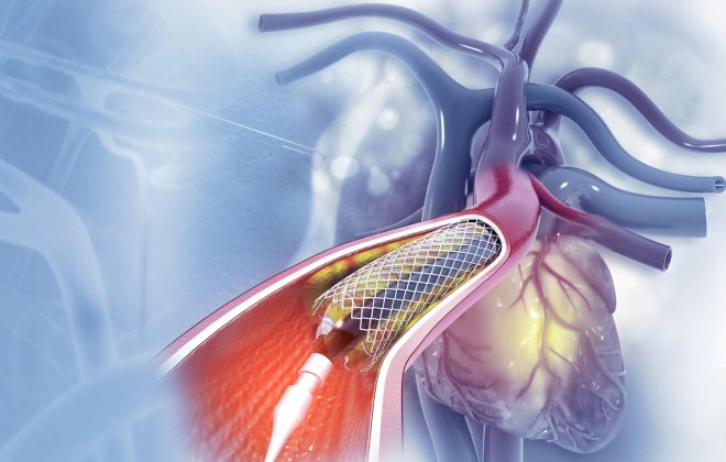 Interventional Cardiology at Yashroop Hospital Gurgaon
