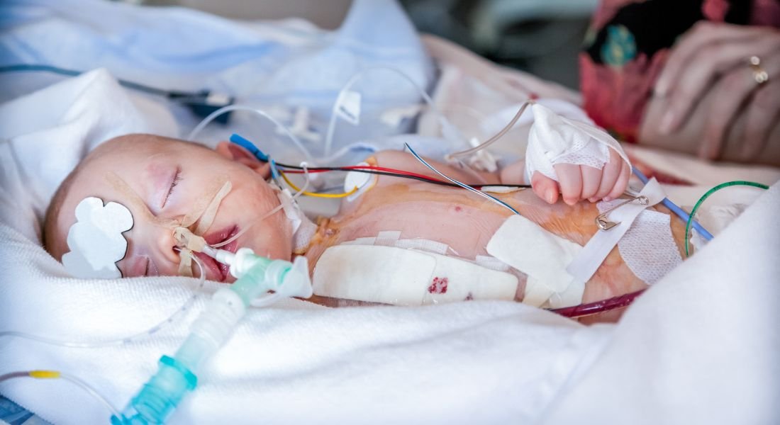 Pediatric Intensive Care